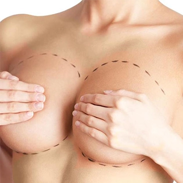 Breast Augementatıon | Antalya Plastic Surgery