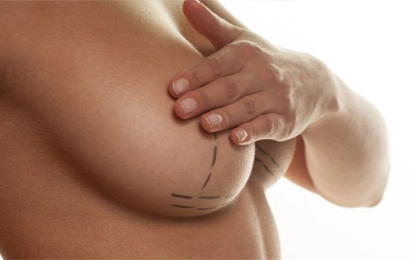 Breast Reductıon | Antalya Plastic Surgery