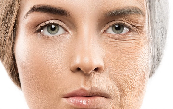 Face Lift | Antalya Plastic Surgery