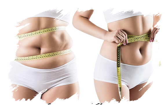 Body Lift | Antalya Plastic Surgery