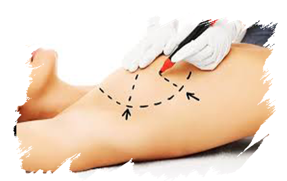 Breast Reconstructıon | Antalya Plastic Surgery