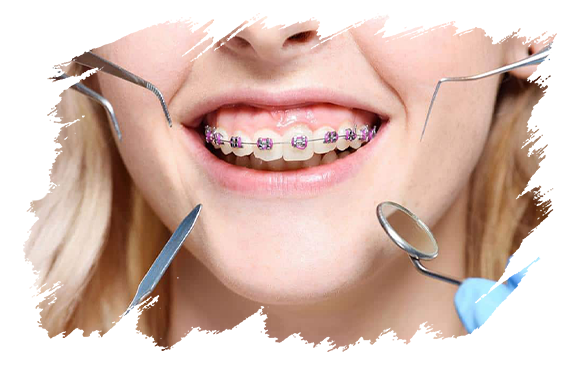 Dentofacial | Antalya Plastic Surgery